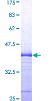 12.5% SDS-PAGE Stained with Coomassie Blue.